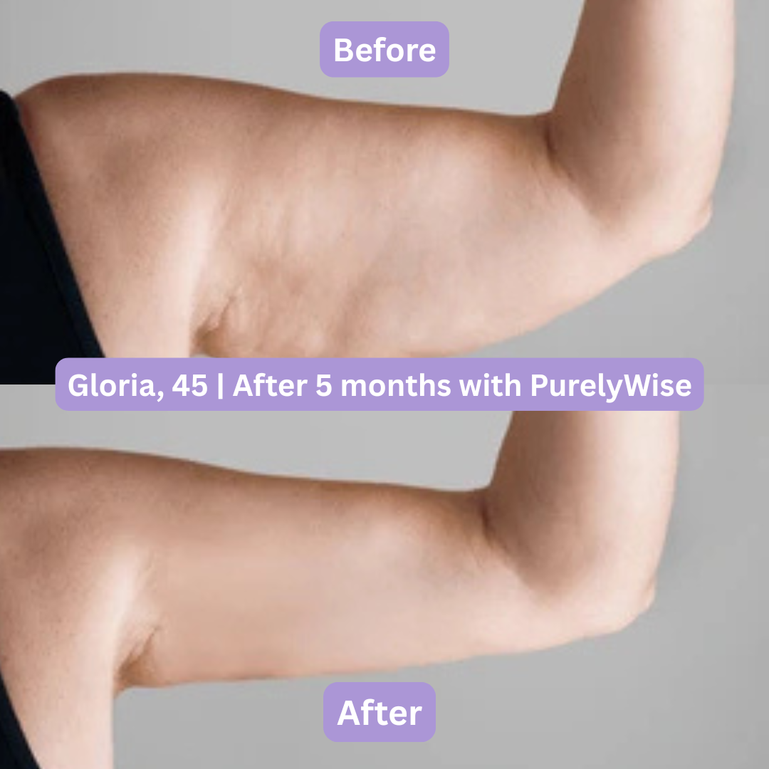 PurelyWise™ Sculpt & Tone Arm Cream