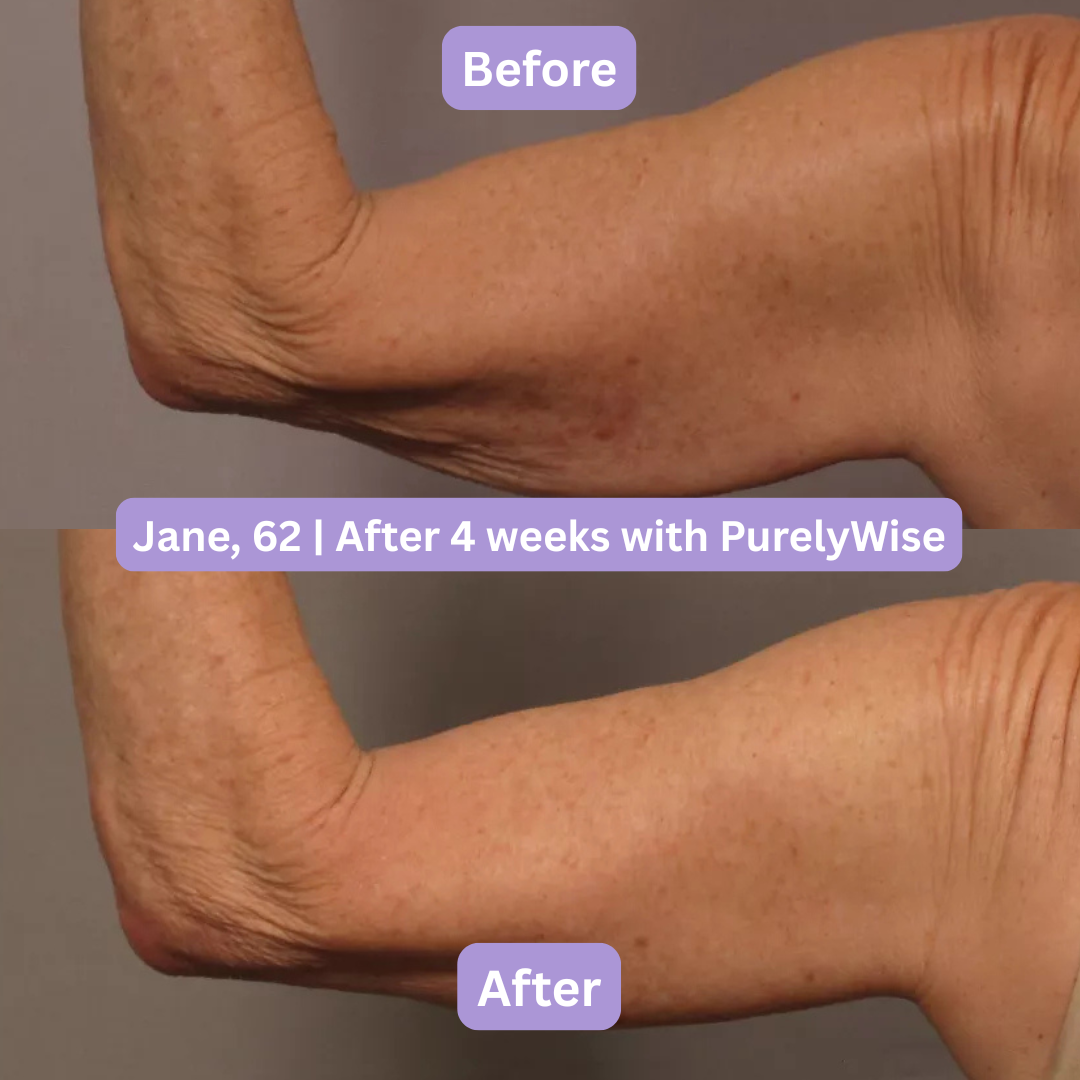 PurelyWise™ Sculpt & Tone Arm Cream