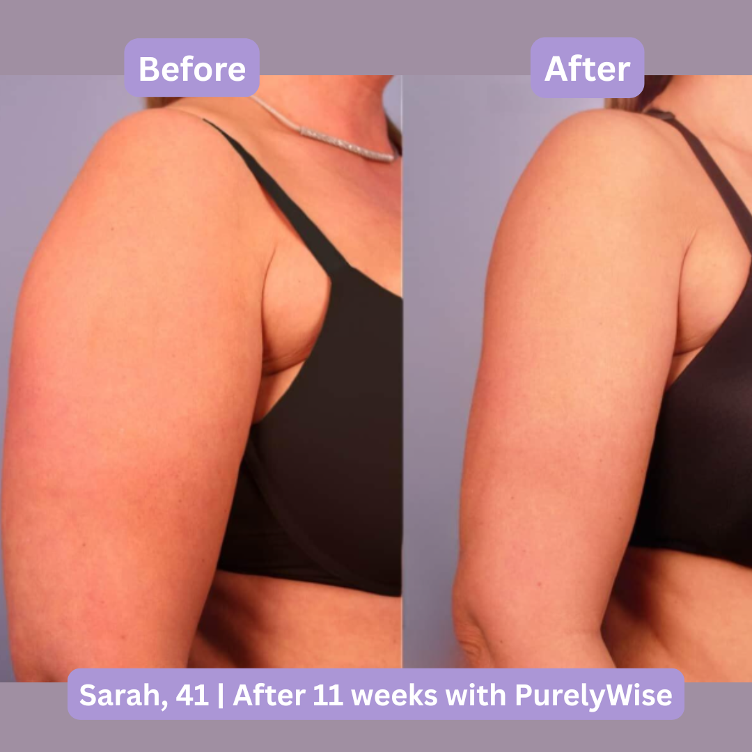 PurelyWise™ Sculpt & Tone Arm Cream