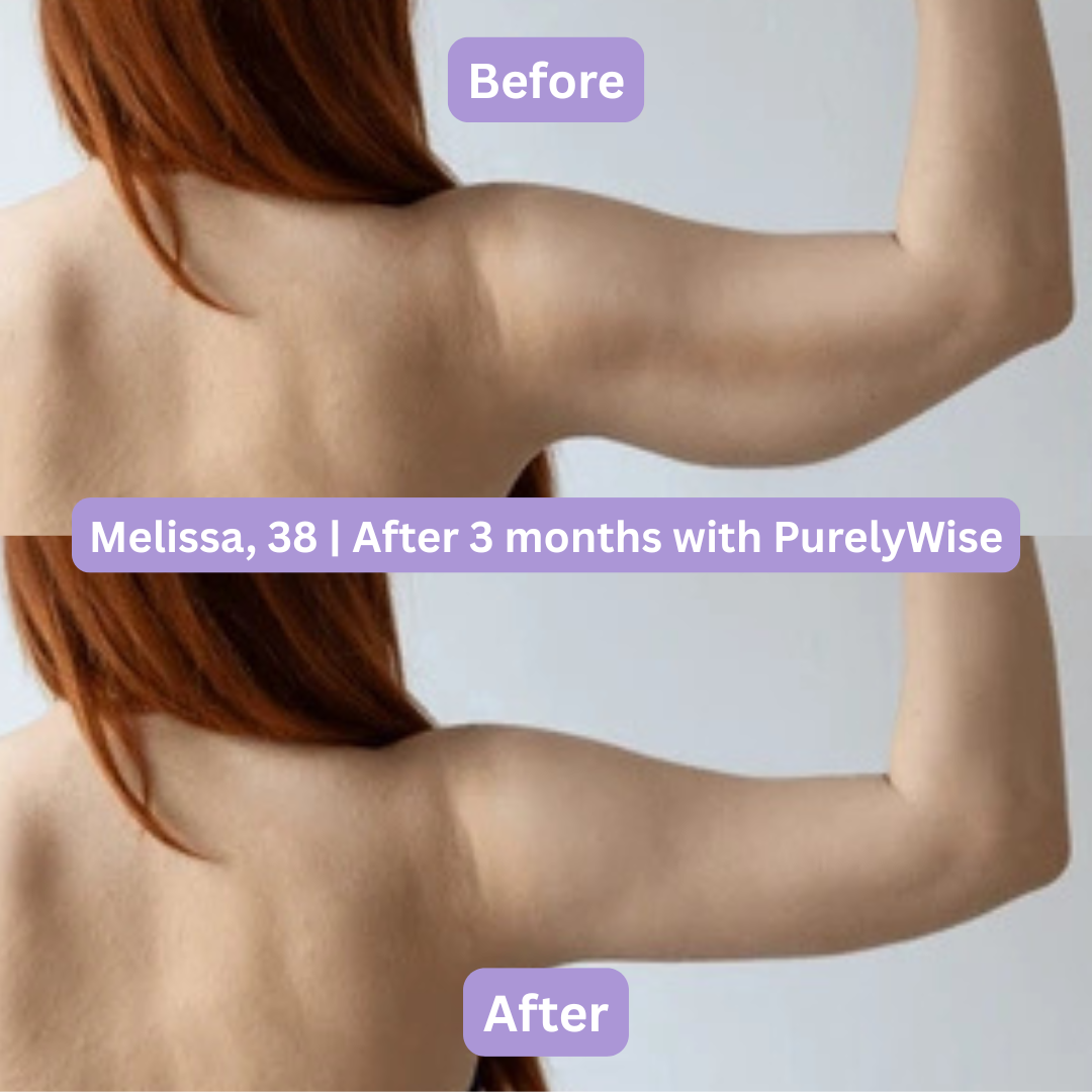 PurelyWise™ Sculpt & Tone Arm Cream